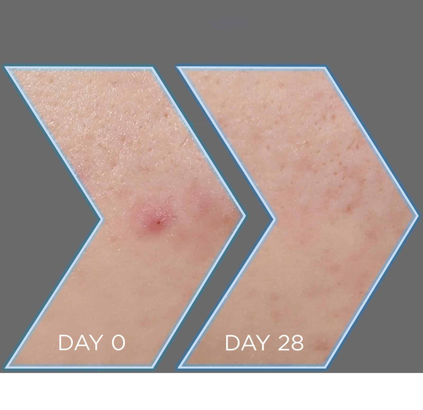 Garnier Pure Active Charbon Sérum anti-imperfections