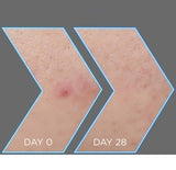 Garnier Pure Active Charbon Sérum anti-imperfections